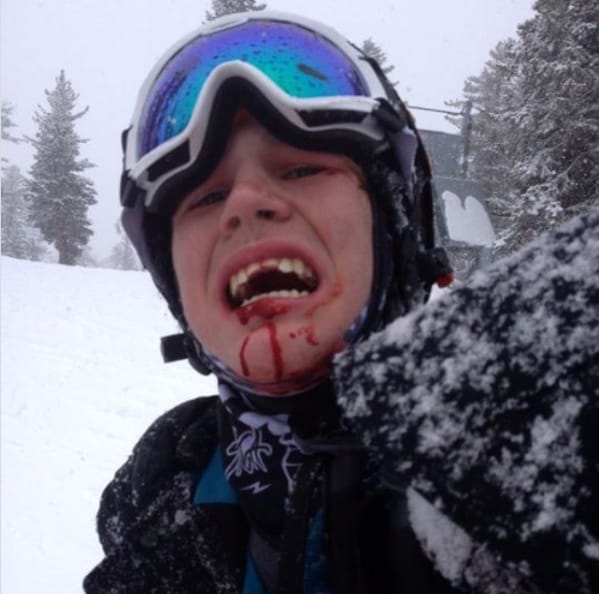 Screenshot illustrating a skiing habit